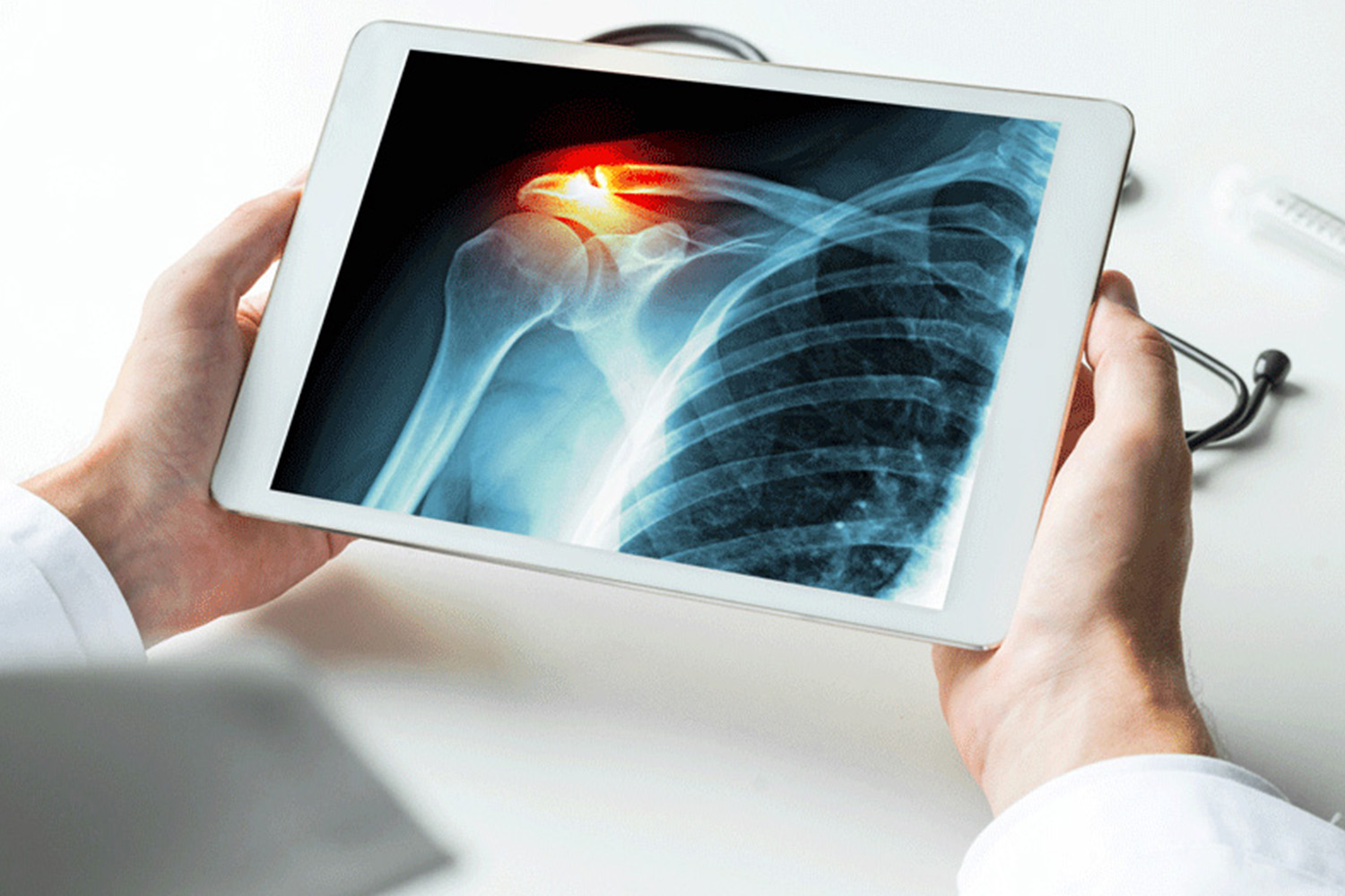 Digital X-Ray